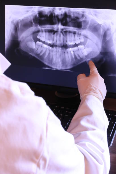 Best Cracked Tooth Emergency Dentist  in San Juan, TX