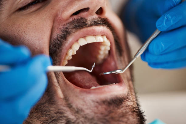 Best Teeth Whitening  in San Juan, TX